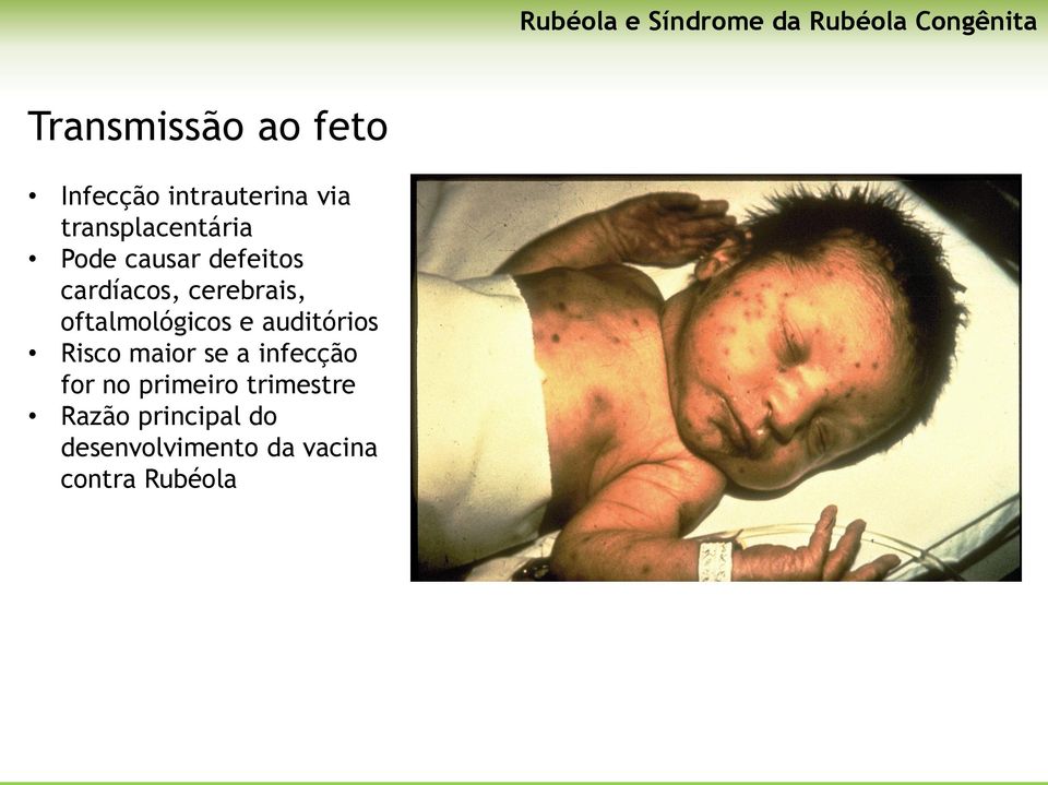 cerebrais, oftalmológicos e auditórios Risco maior se a infecção for no