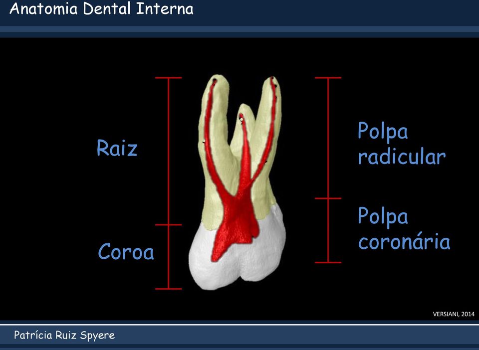 radicular Coroa