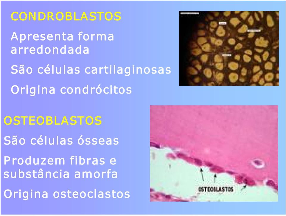 condrócitos OSTEOBLASTOS São células ósseas