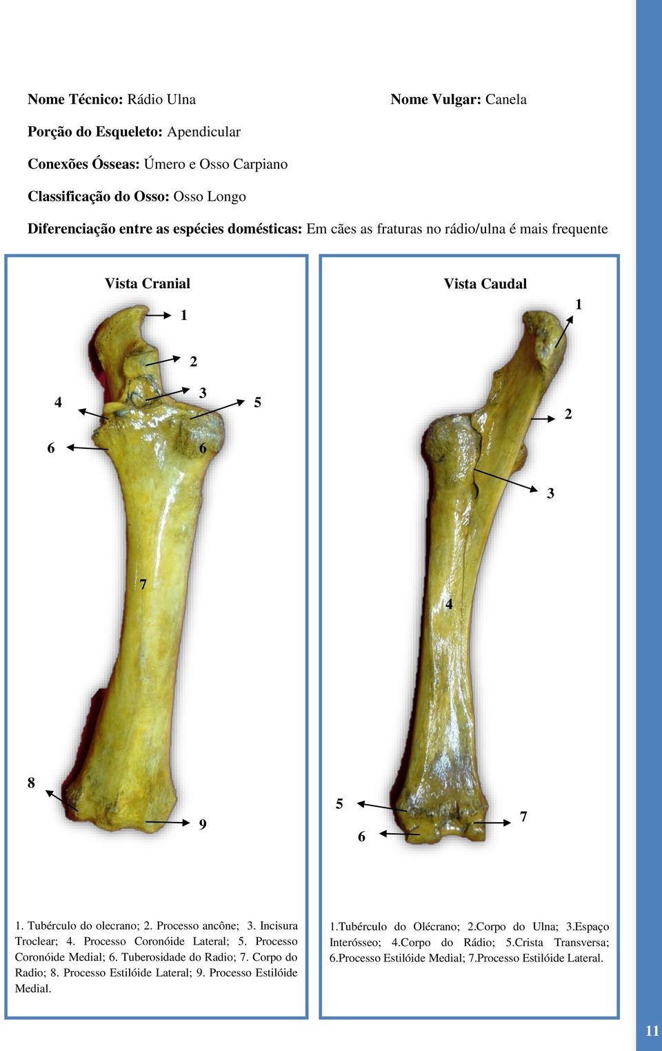 Processo ancône;. Incisura Troclear;. Processo Coronóide Lateral;. Processo Coronóide Medial;. Tuberosidade do Radio; 7. Corpo do Radio; 8.