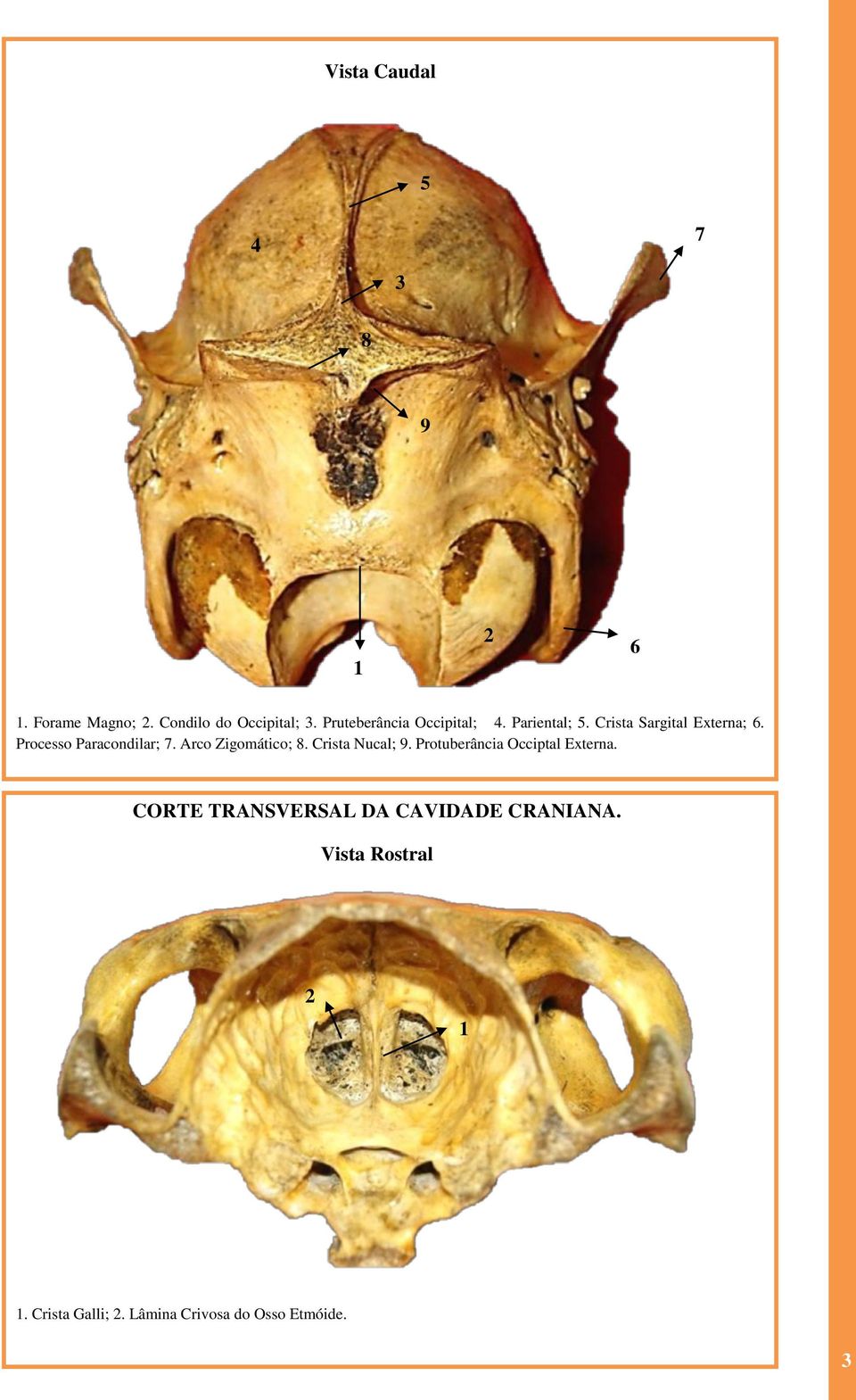 Processo Paracondilar; 7. Arco Zigomático; 8. Crista Nucal; 9.