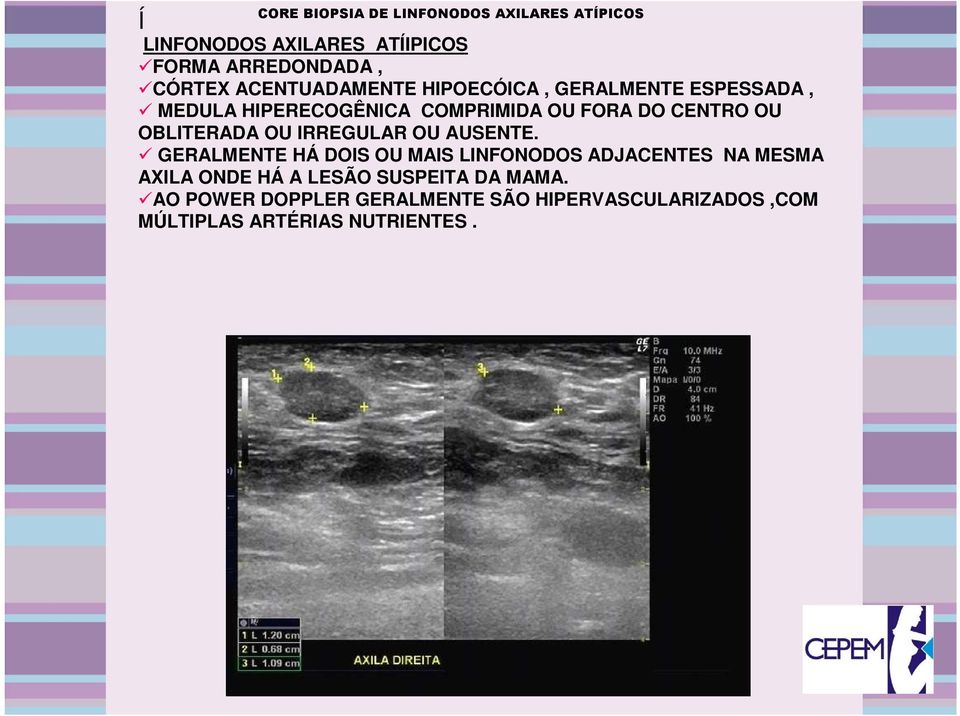 OBLITERADA OU IRREGULAR OU AUSENTE.