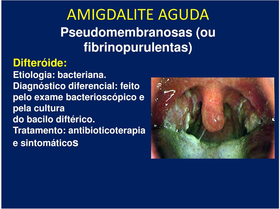 Diagnóstico diferencial: feito pelo exame bacterioscópico