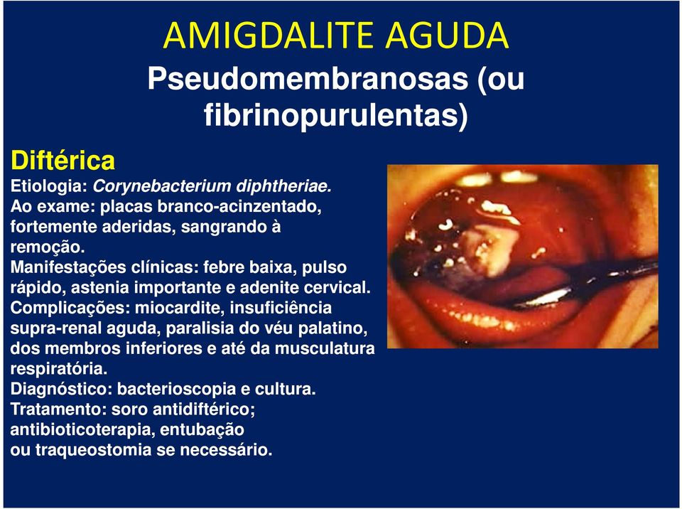 Manifestações clínicas: febre baixa, pulso rápido, astenia importante e adenite cervical.