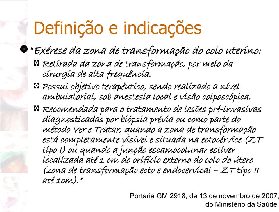 Recomendada para o tratamento de lesões pré-invasivas diagnosticadas por biópsia prévia ou como parte do método Ver e Tratar, quando a zona de transformação está completamente