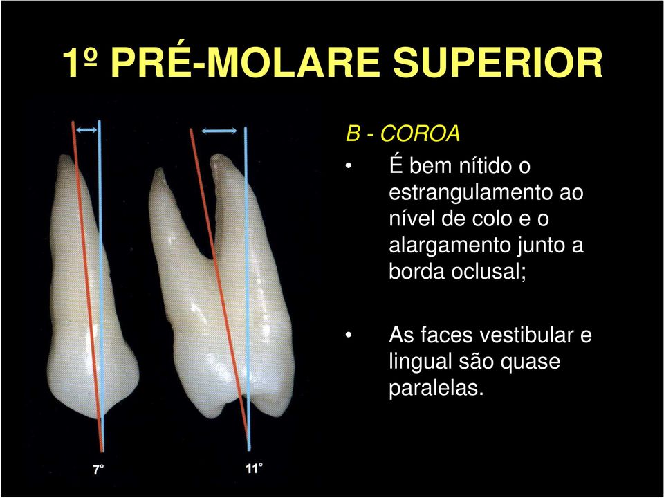 e o alargamento junto a borda oclusal; As