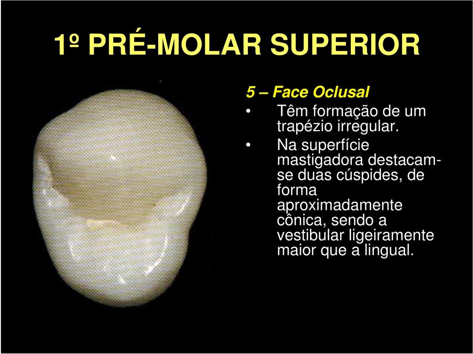 Na superfície mastigadora destacamse duas