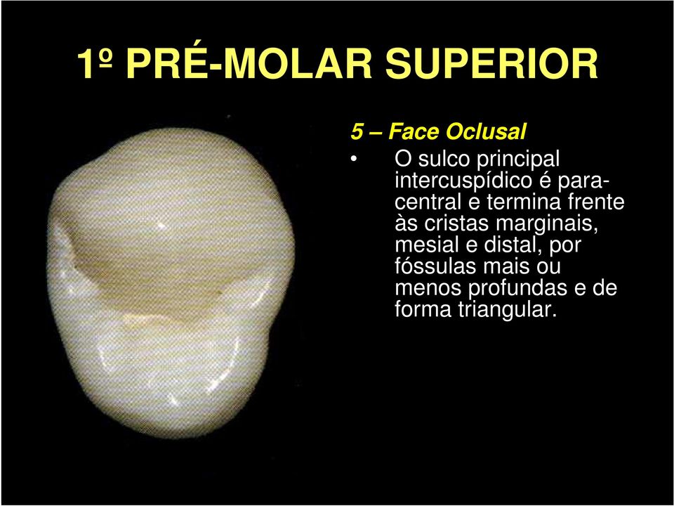 frente às cristas marginais, mesial e