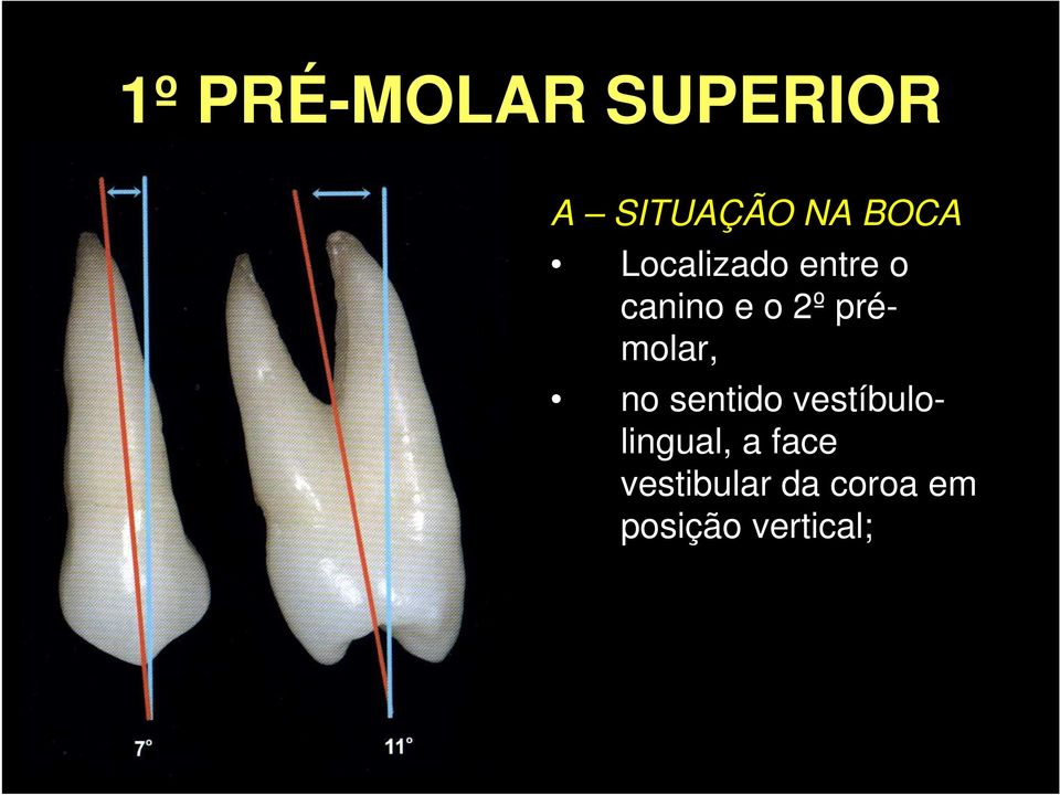 sentido vestíbulolingual, a face