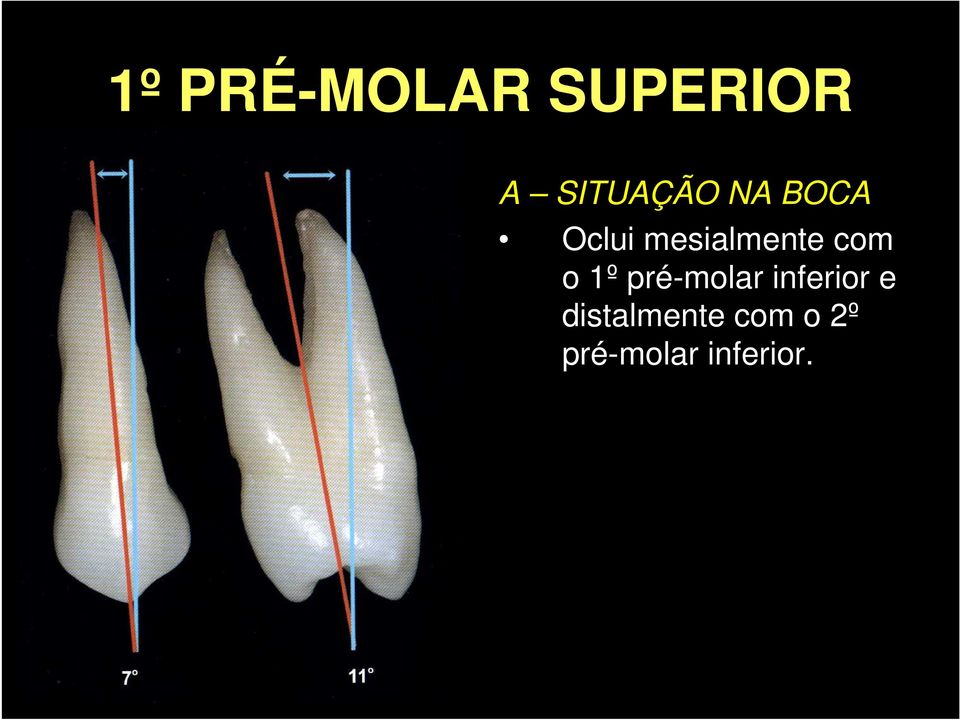 pré-molar inferior e