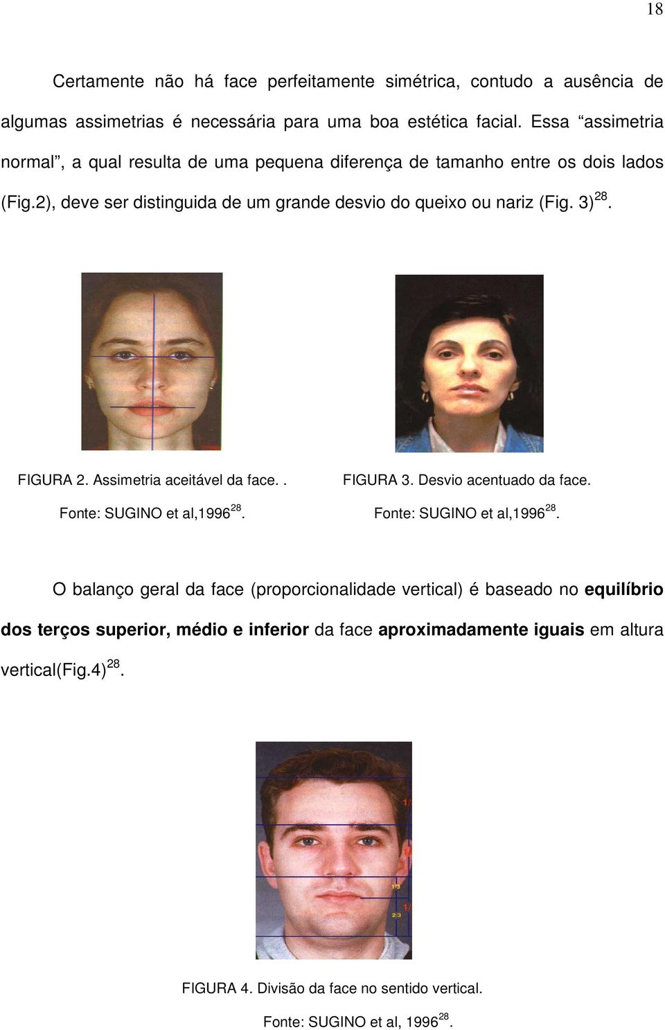 3) 28. FIGURA 2. Assimetria aceitável da face.. Fonte: SUGINO et al,1996 28.