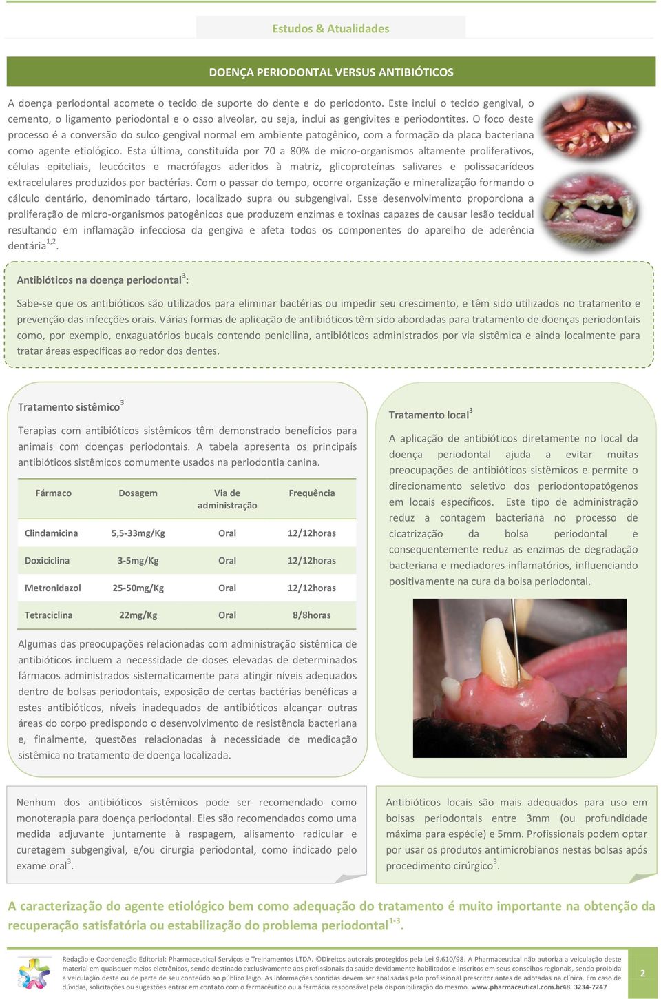 O foco deste processo é a conversão do sulco gengival normal em ambiente patogênico, com a formação da placa bacteriana como agente etiológico.