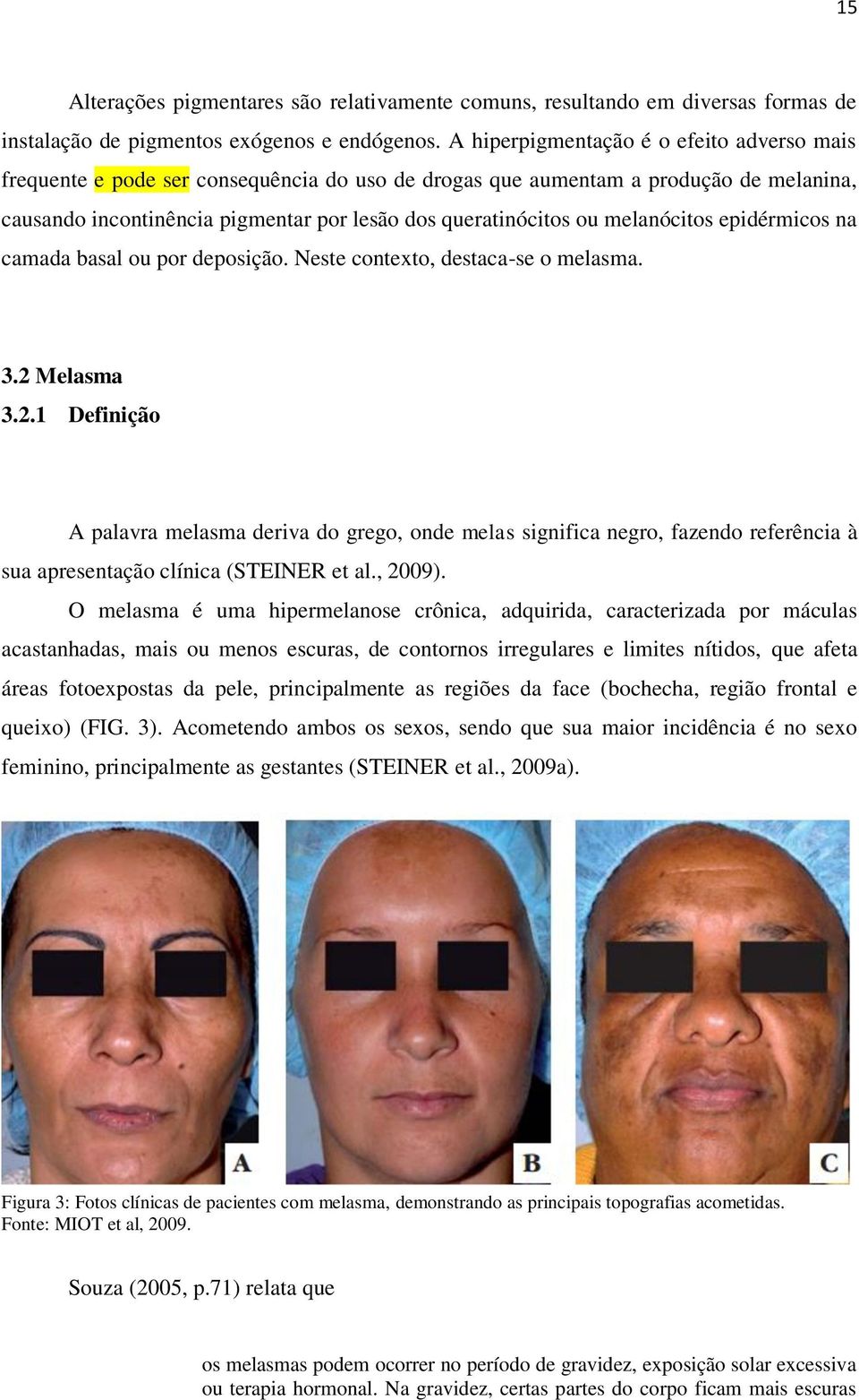 melanócitos epidérmicos na camada basal ou por deposição. Neste contexto, destaca-se o melasma. 3.2 