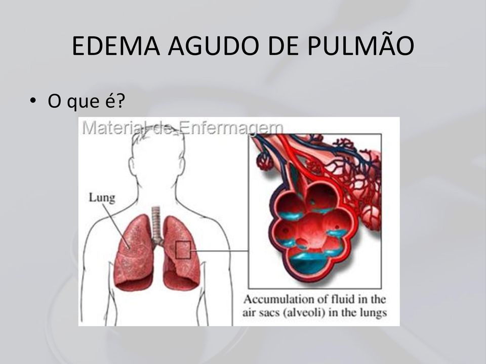 PULMÃO O