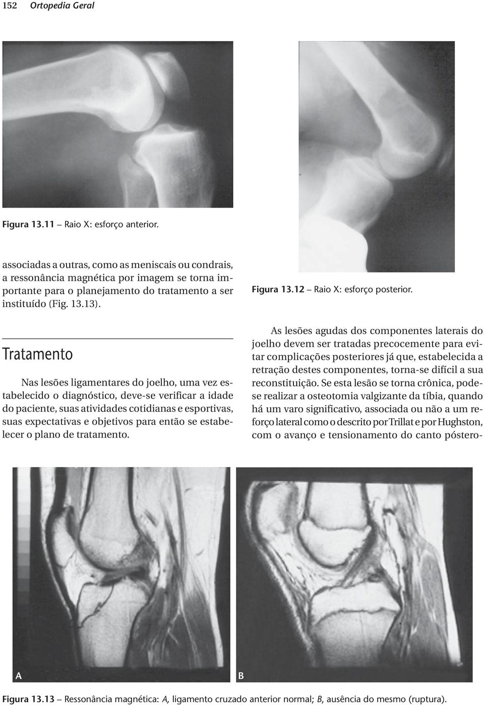 12 Raio X: esforço posterior.