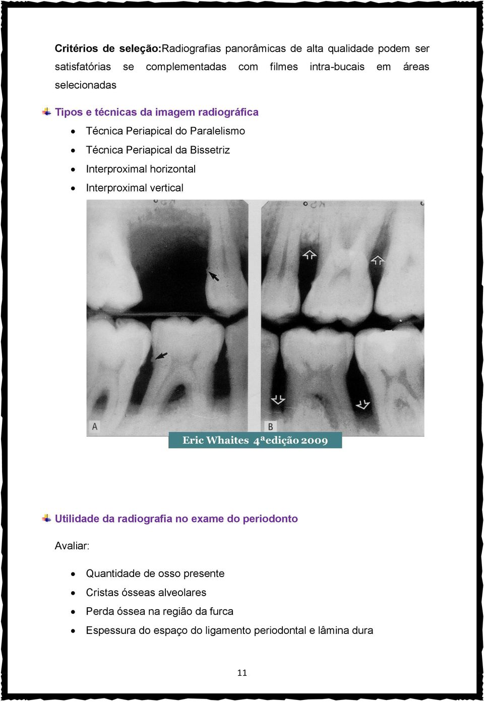 da Bissetriz Interproximal horizontal Interproximal vertical Utilidade da radiografia no exame do periodonto Avaliar: