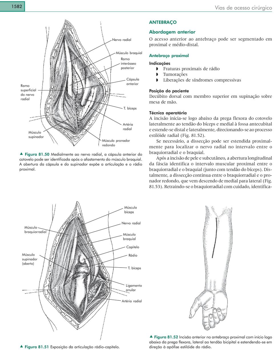 A abertura da cápsula e do supinador expõe a articulação e o rádio proximal. Abordagem anterior O acesso anterior ao antebraço pode ser segmentado em proximal e médio-distal.