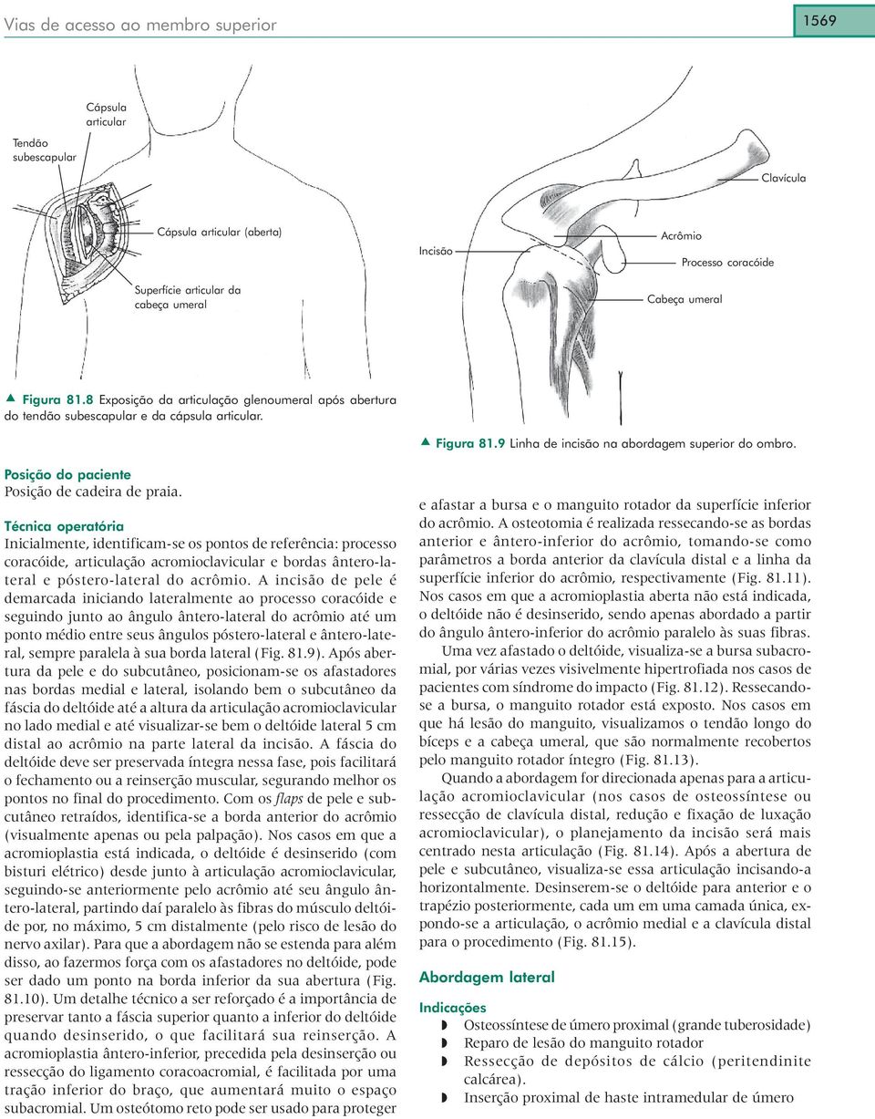 Inicialmente, identificam-se os pontos de referência: processo coracóide, articulação acromioclavicular e bordas ântero-lateral e póstero-lateral do acrômio.