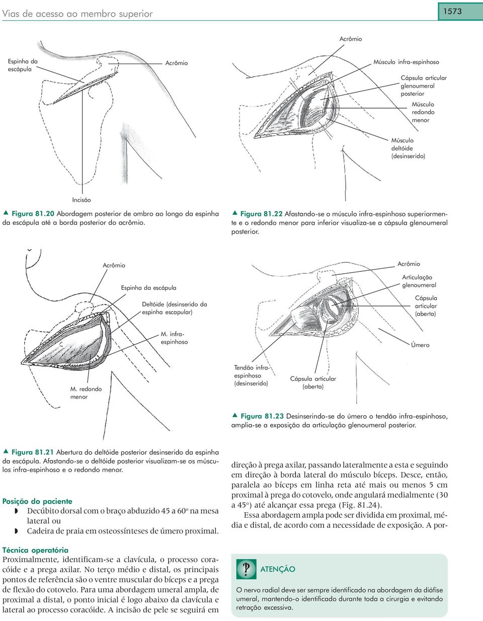 22 Afastando-se o músculo infra-espinhoso superiormente e o redondo menor para inferior visualiza-se a cápsula glenoumeral posterior.