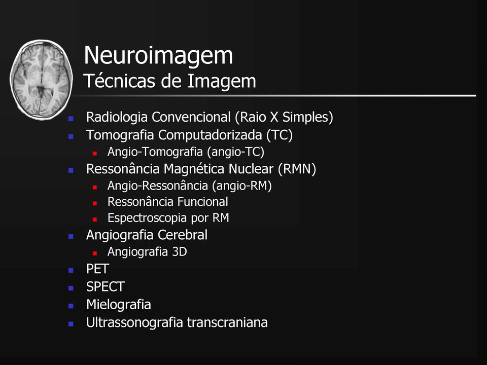(RMN) Angio-Ressonância (angio-rm) Ressonância Funcional Espectroscopia por RM