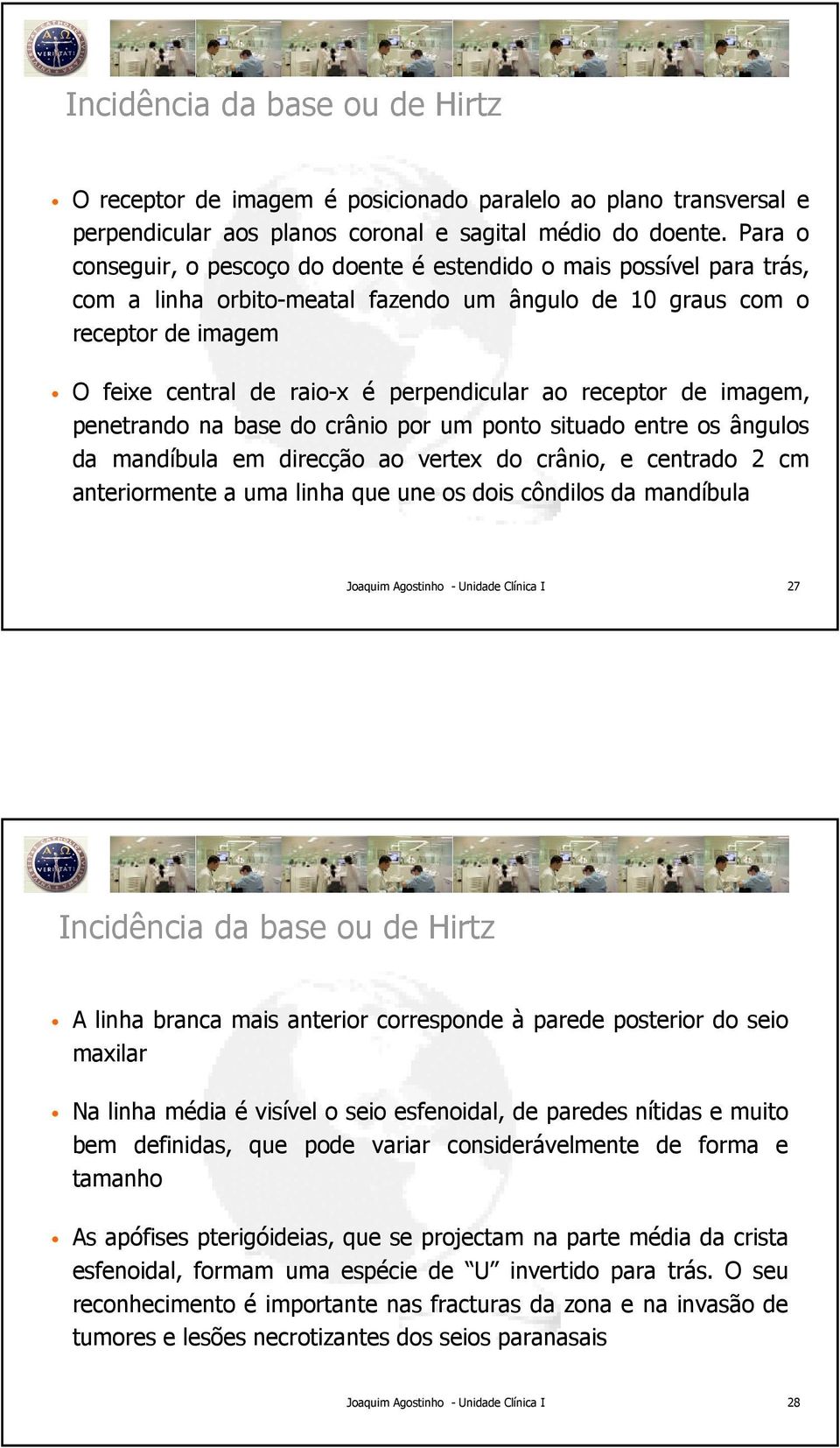 ao receptor de imagem, penetrando na base do crânio por um ponto situado entre os ângulos da mandíbula em direcção ao vertex do crânio, e centrado 2 cm anteriormente a uma linha que une os dois