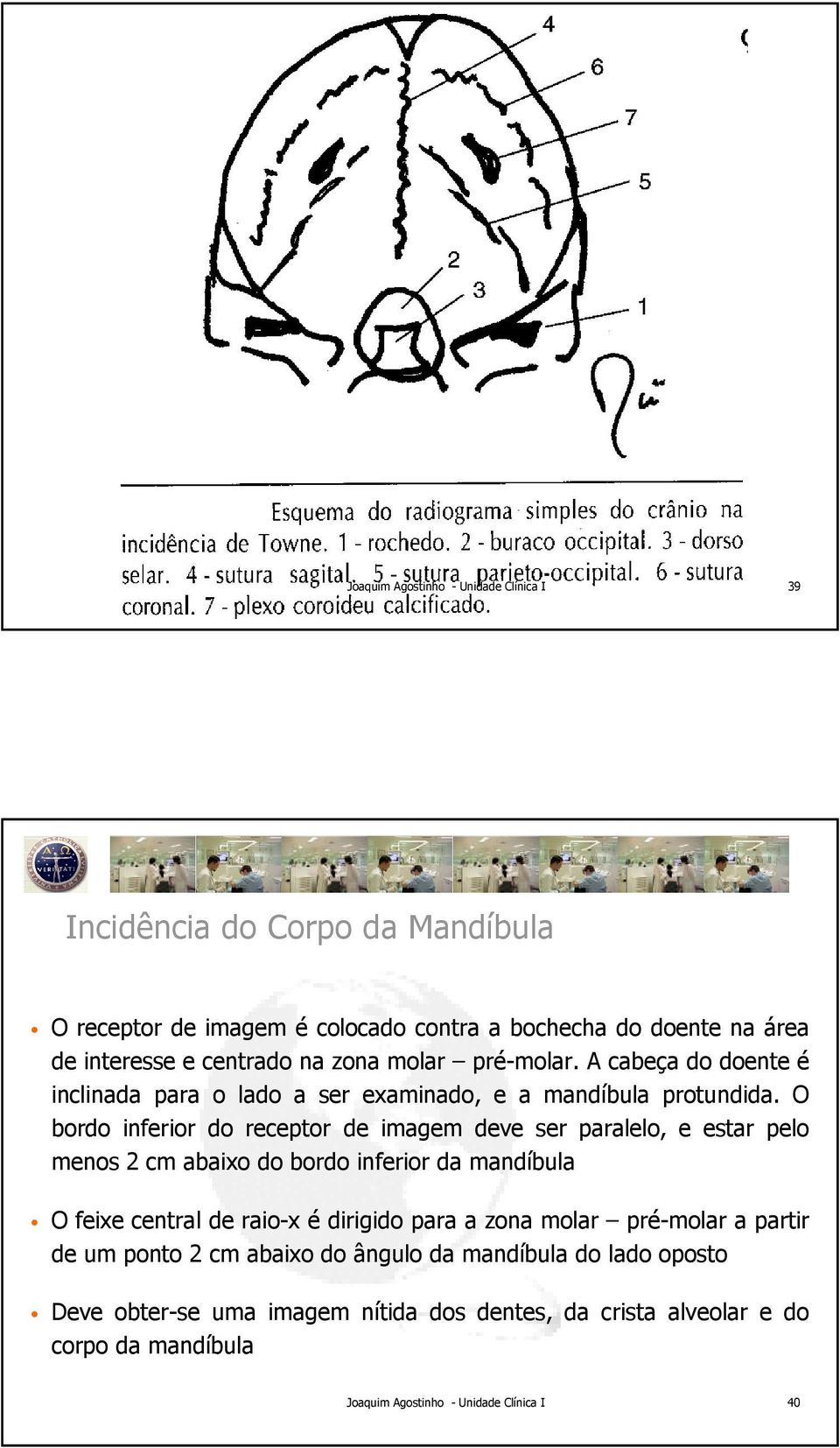 O bordo inferior do receptor de imagem deve ser paralelo, e estar pelo menos 2 cm abaixo do bordo inferior da mandíbula O feixe central de raio-x