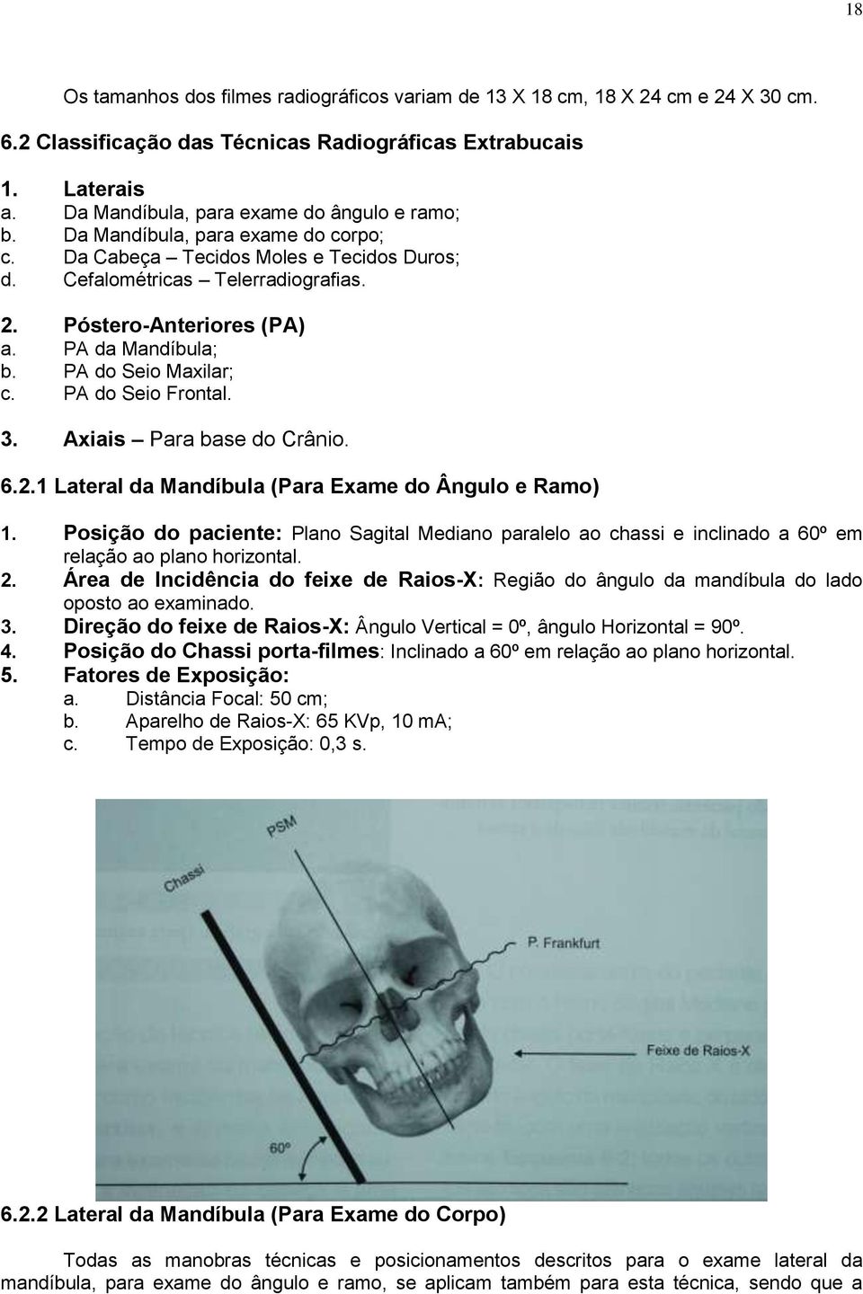 PA da Mandíbula; b. PA do Seio Maxilar; c. PA do Seio Frontal. 3. Axiais Para base do Crânio. 6.2.1 Lateral da Mandíbula (Para Exame do Ângulo e Ramo) 1.