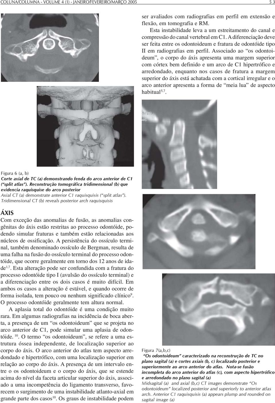 Associado ao os odontoideum, o corpo do áxis apresenta uma margem superior com córtex bem definido e um arco de C1 hipertrófico e arredondado, enquanto nos casos de fratura a margem superior do áxis