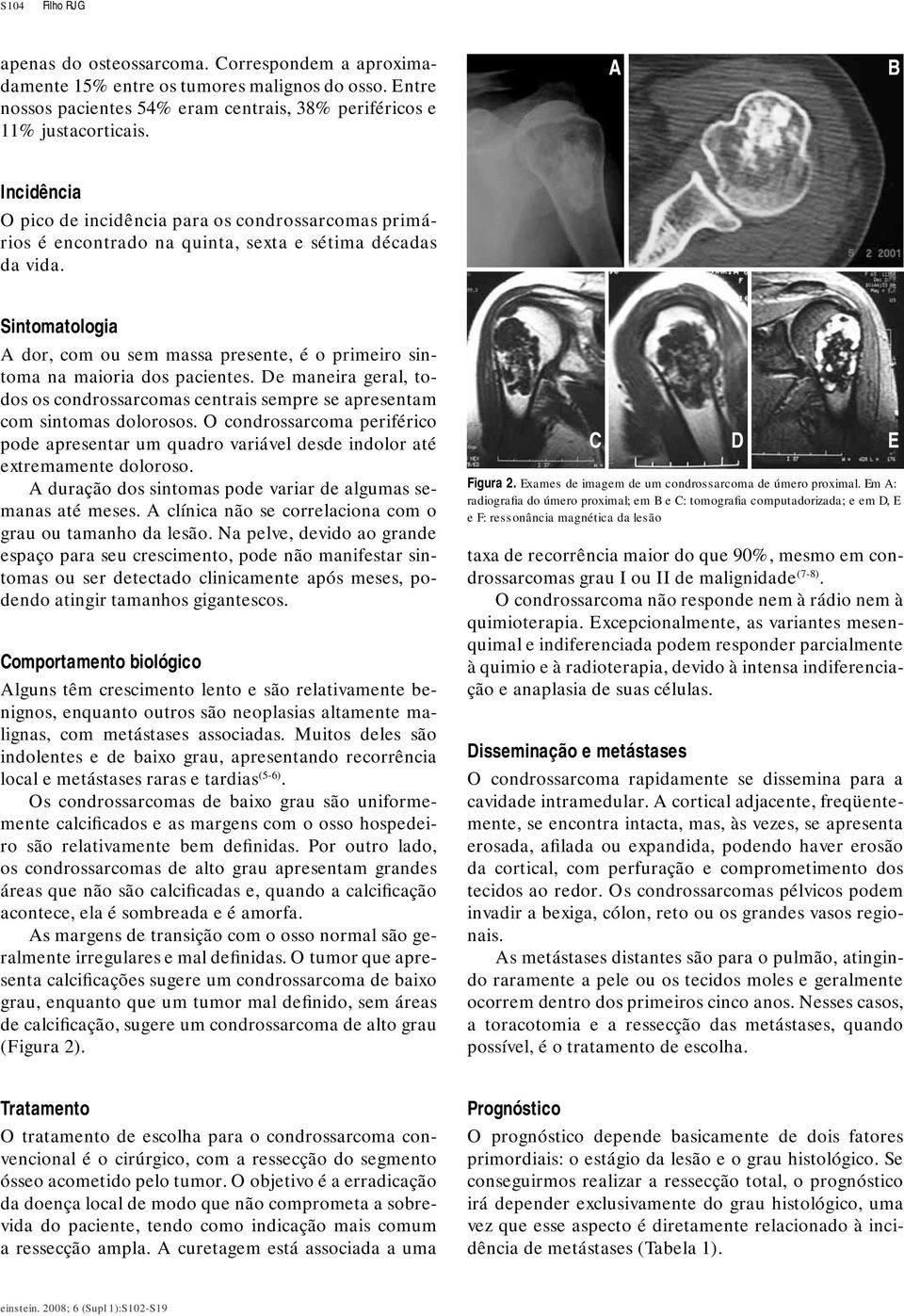 Sintomatologia A dor, com ou sem massa presente, é o primeiro sintoma na maioria dos pacientes. De maneira geral, todos os condrossarcomas centrais sempre se apresentam com sintomas dolorosos.