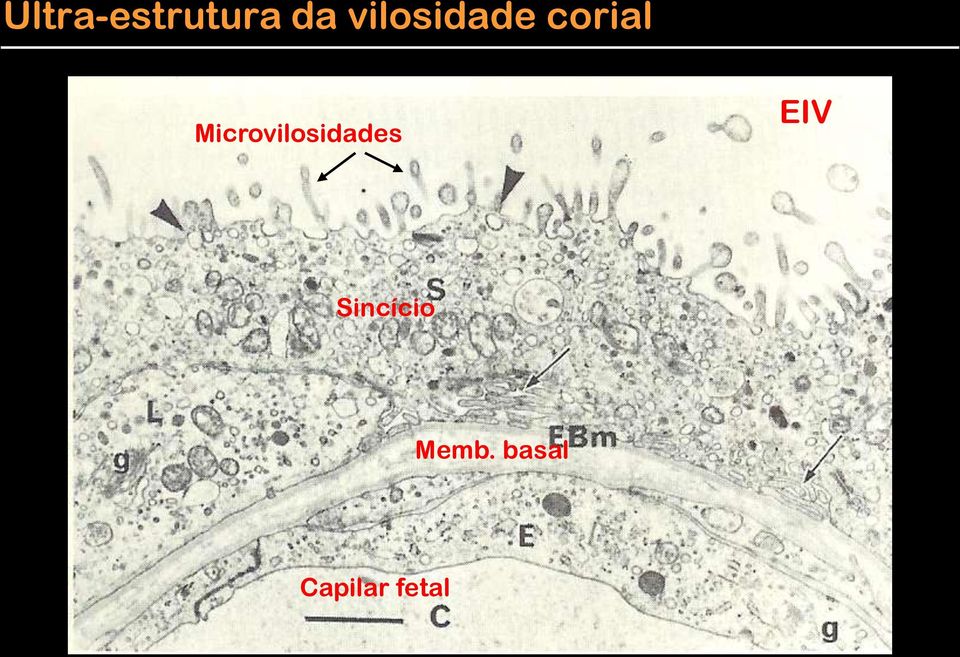 Microvilosidades EIV