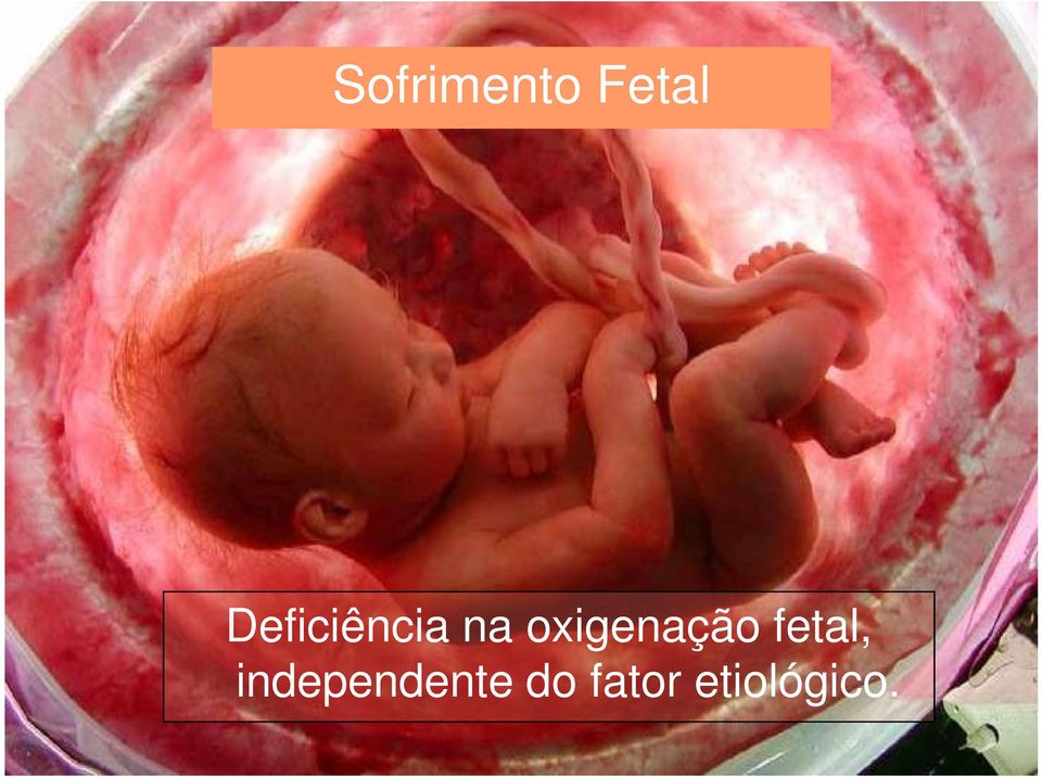 oxigenação fetal,
