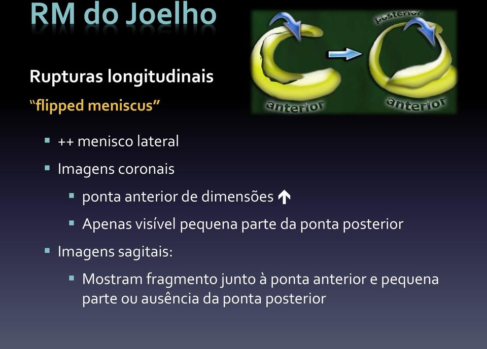 pequena parte da ponta posterior Imagens sagitais: Mostram