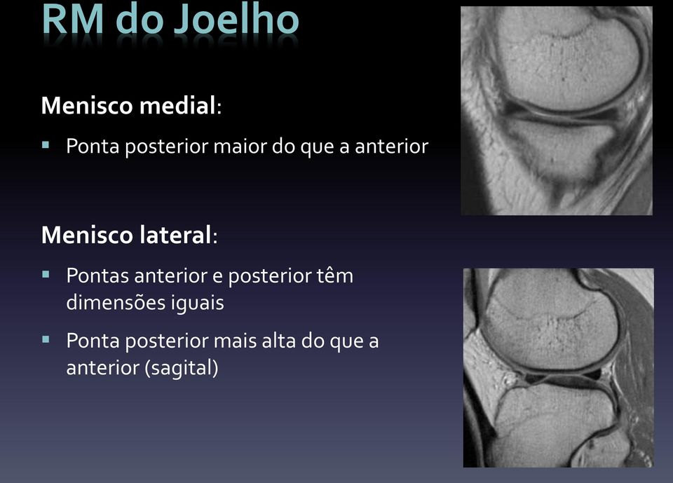 anterior e posterior têm dimensões iguais