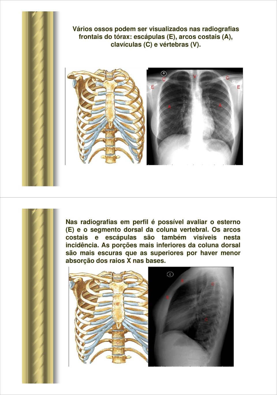 Nas radiografias em perfil é possível avaliar o esterno (E) e o segmento dorsal da coluna vertebral.