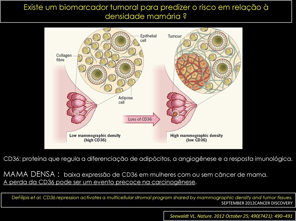 MAMA DENSA : baixa expressão de CD36 em mulheres com ou sem câncer de mama.