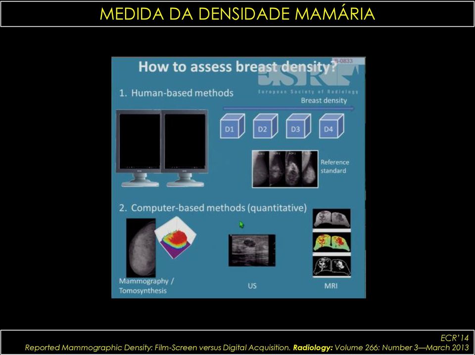 Film-Screen versus Digital