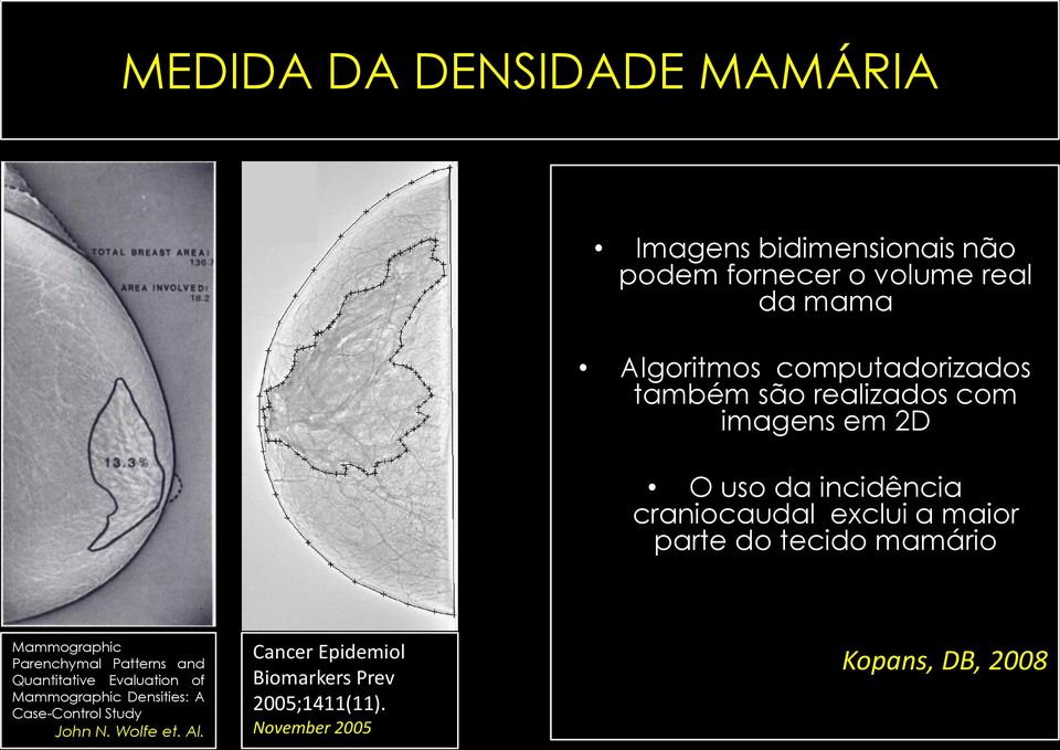 do tecido mamário Mammographic Parenchymal Patterns and Quantitative Evaluation of Mammographic Densities: A