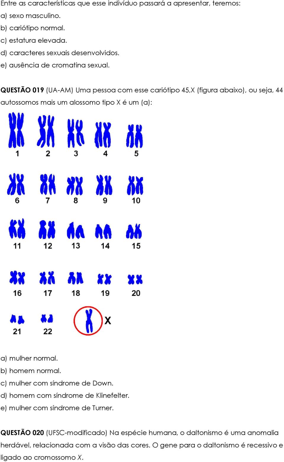 QUESTÃO 019 (UA-AM) Uma pessoa com esse cariótipo 45,X (figura abaixo), ou seja, 44 autossomos mais um alossomo tipo X é um (a): a) mulher normal. b) homem normal.