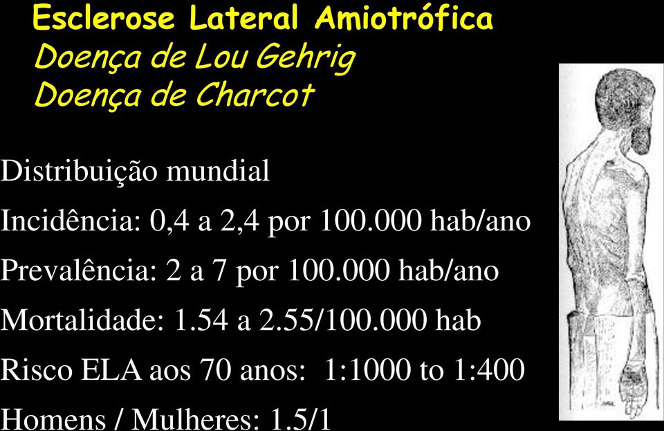 000 hab/ano Prevalência: 2 a 7 por 100.000 hab/ano Mortalidade: 1.