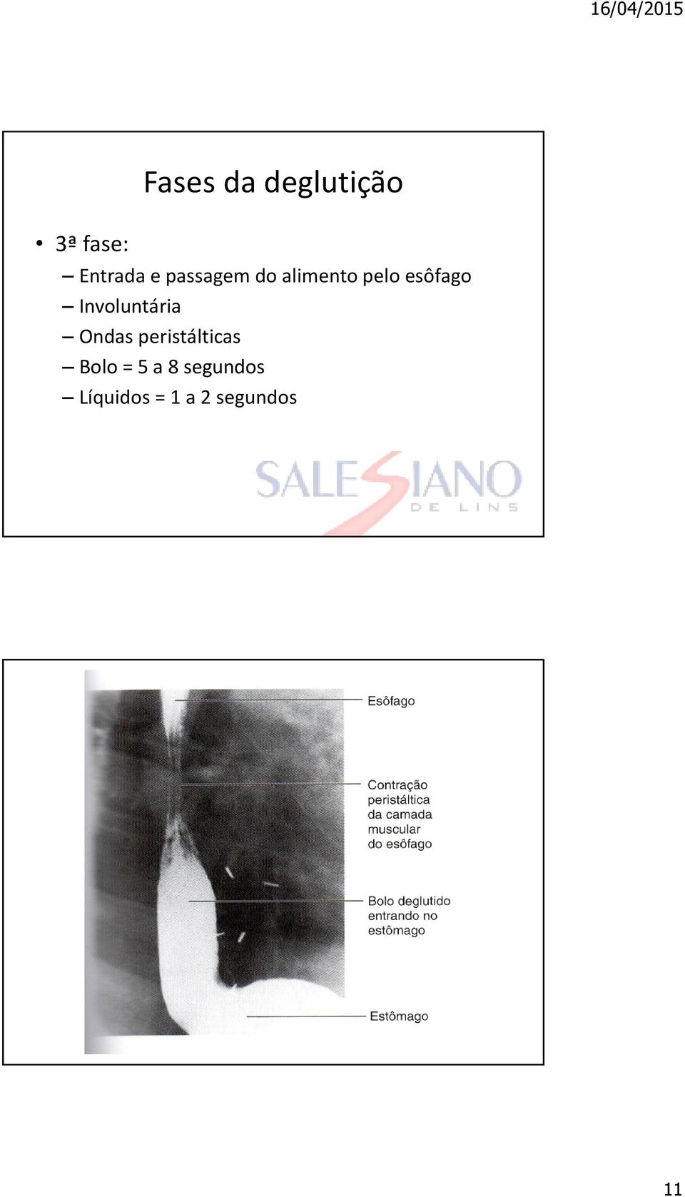 Involuntária Ondas peristálticas Bolo