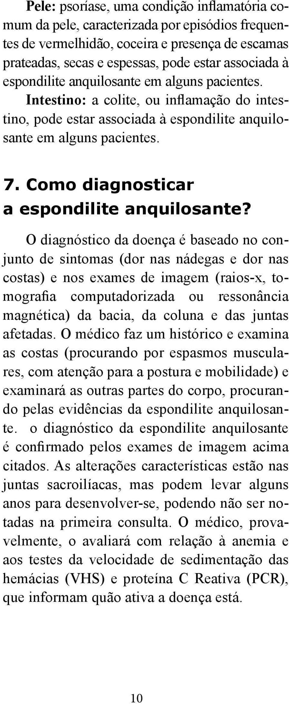 Como diagnosticar a espondilite anquilosante?