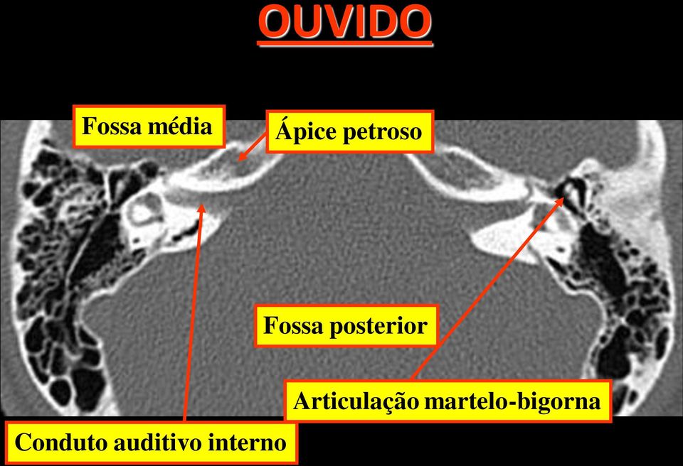 Conduto auditivo