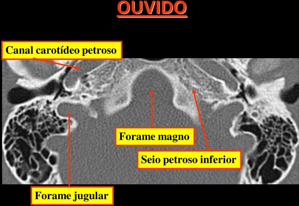 magno Seio petroso