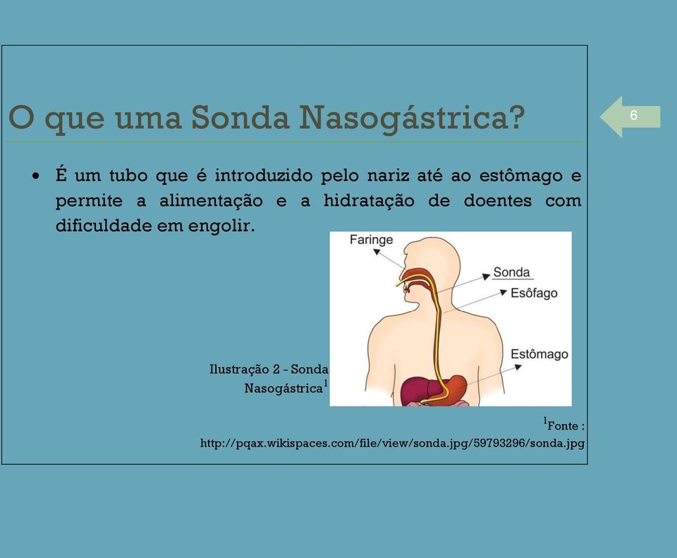 alimentação e a hidratação de doentes com dificuldade em engolir.