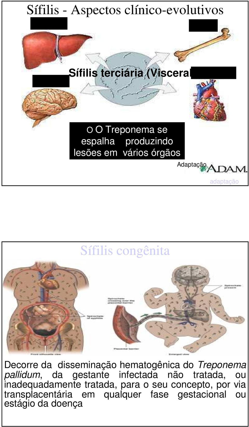 da disseminação hematogênica do Treponema pallidum, da gestante infectada não tratada, ou