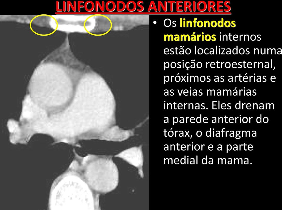 artérias e as veias mamárias internas.
