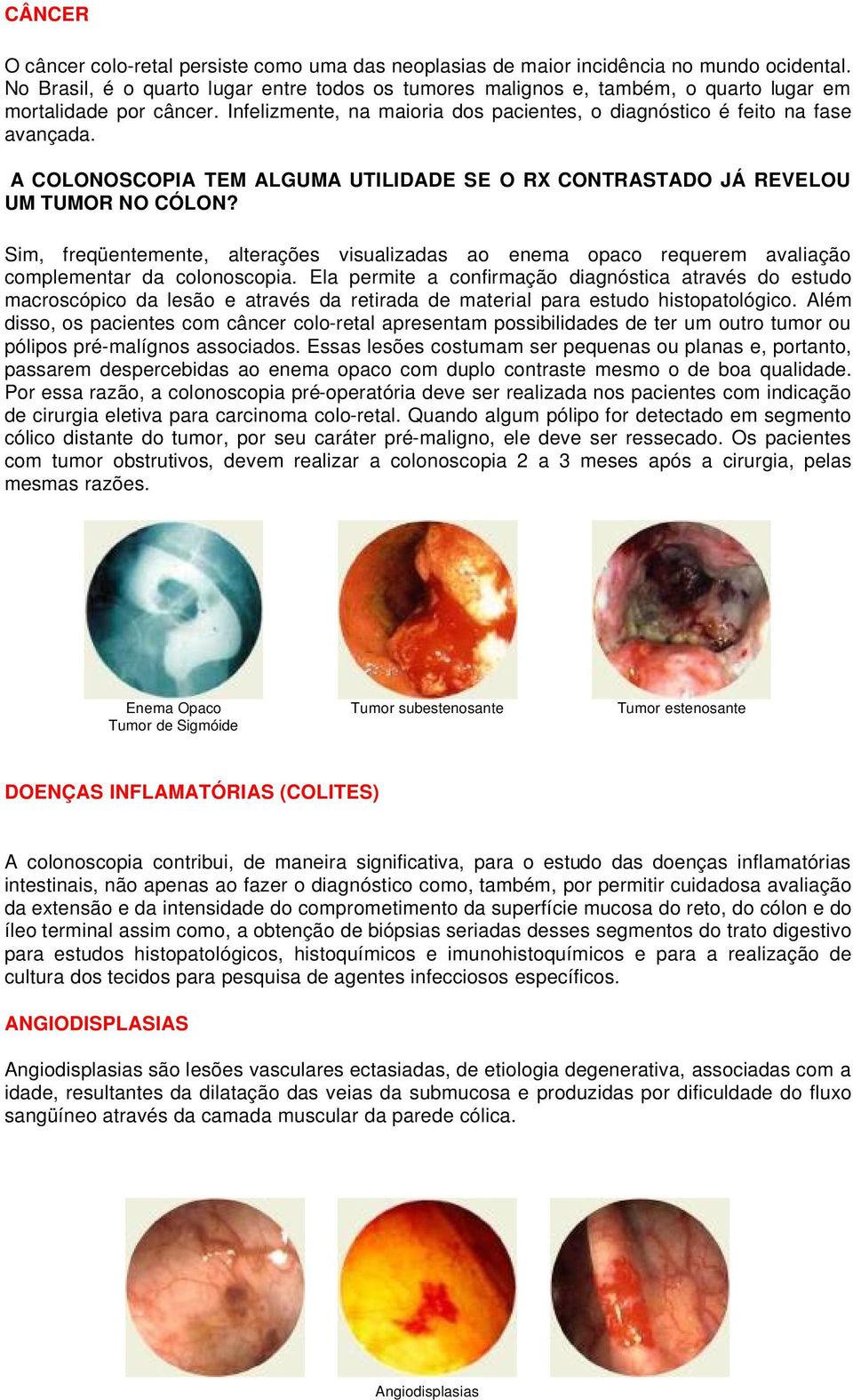 A COLONOSCOPIA TEM ALGUMA UTILIDADE SE O RX CONTRASTADO JÁ REVELOU UM TUMOR NO CÓLON? Sim, freqüentemente, alterações visualizadas ao enema opaco requerem avaliação complementar da colonoscopia.