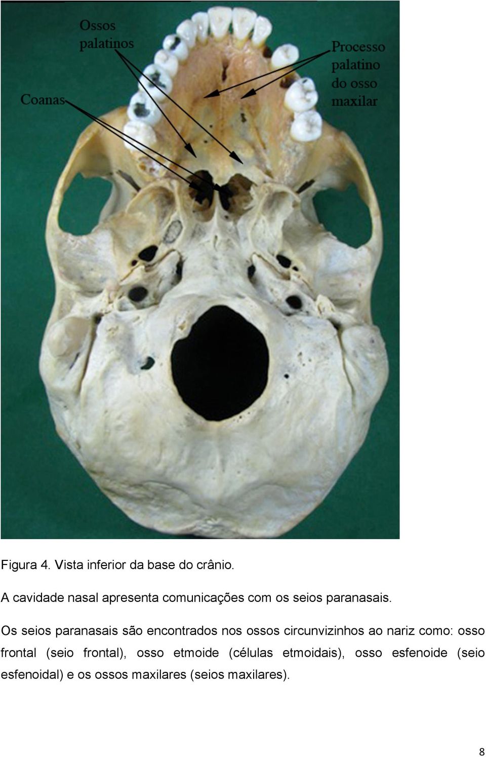 Os seios paranasais são encontrados nos ossos circunvizinhos ao nariz como: osso