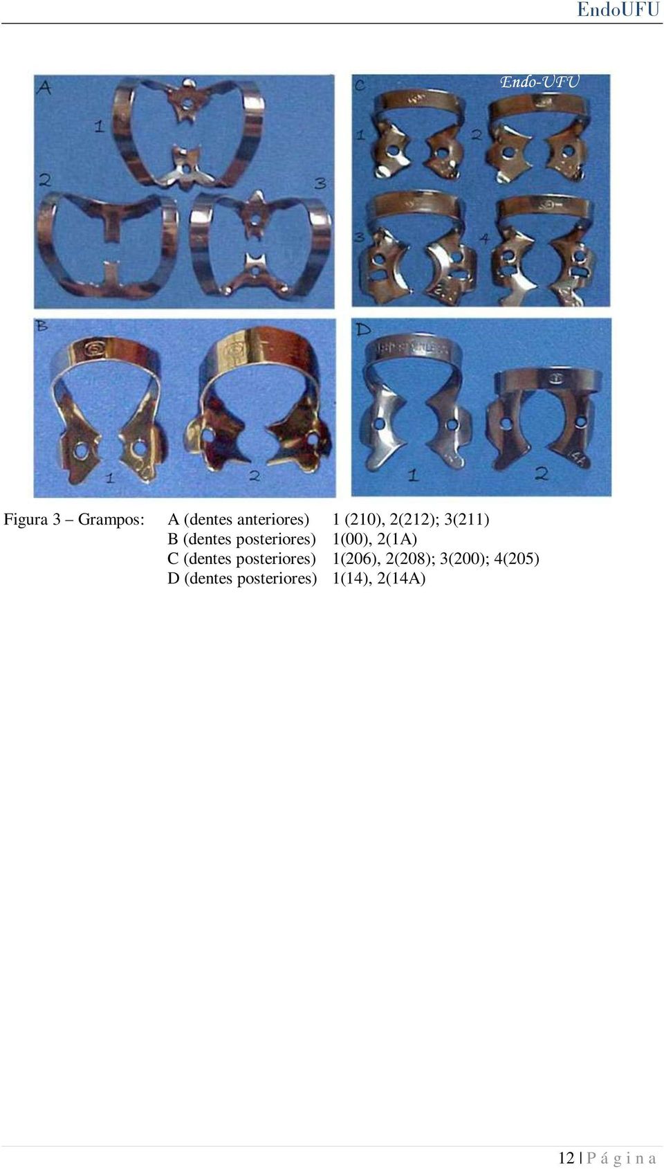 C (dentes posteriores) 1(206), 2(208); 3(200);