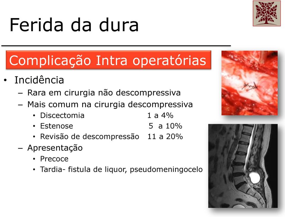 Discectomia 1 a 4% Estenose 5 a 10% Revisão de descompressão 11 a